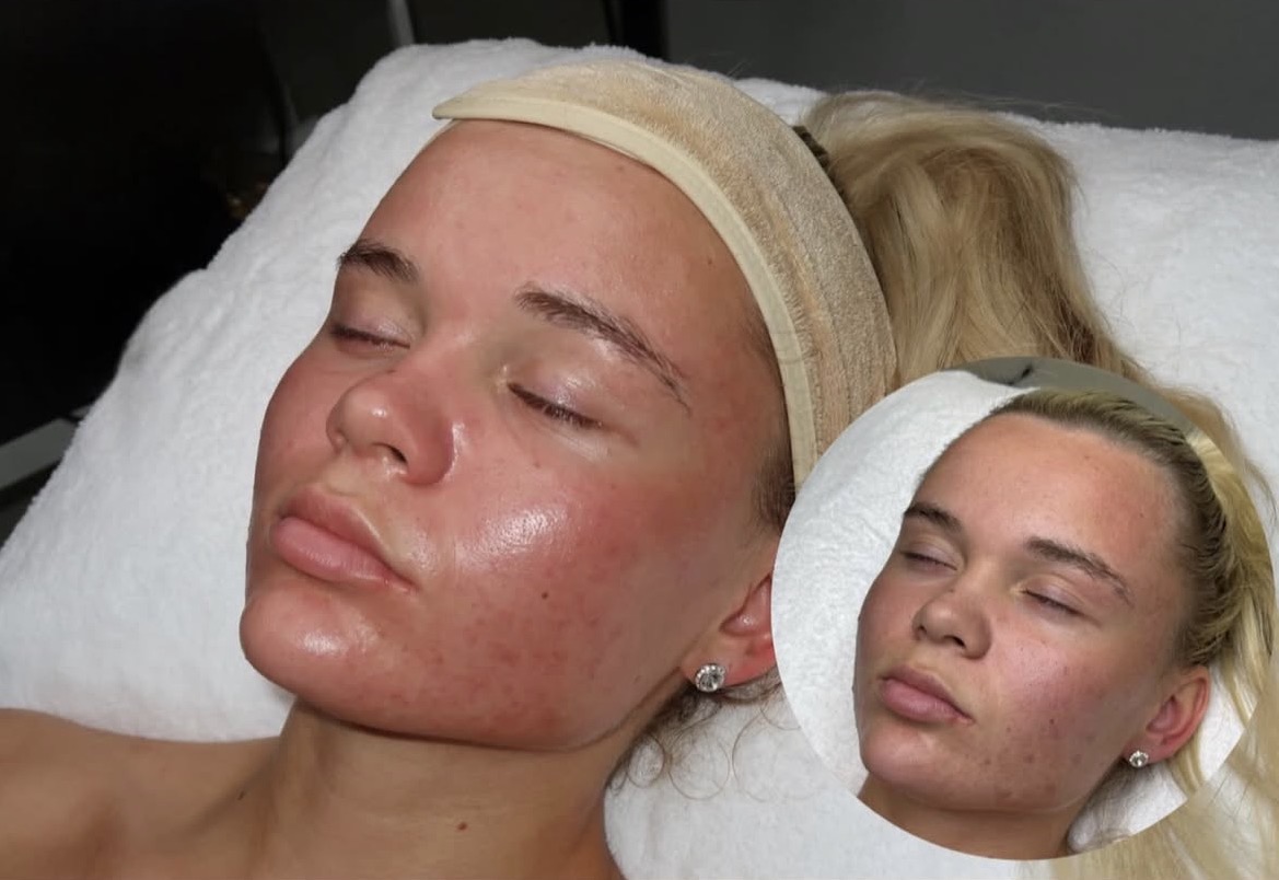 Skin & Rejuvenation